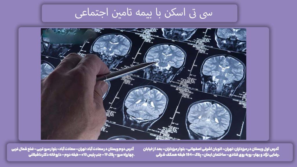 هزینه با تامین اجتماعی مبلغ سی تی اسکن با دفترچه تامین اجتماعی
