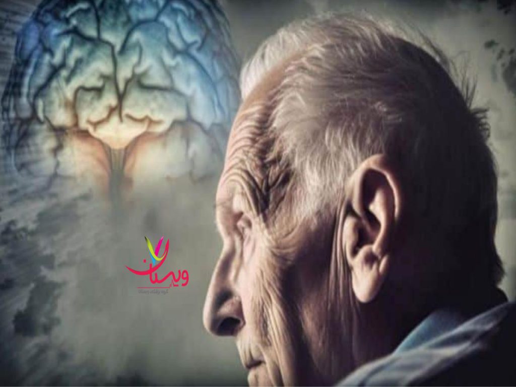 آلزایمر علائم مرگ بیماران آلزایمری