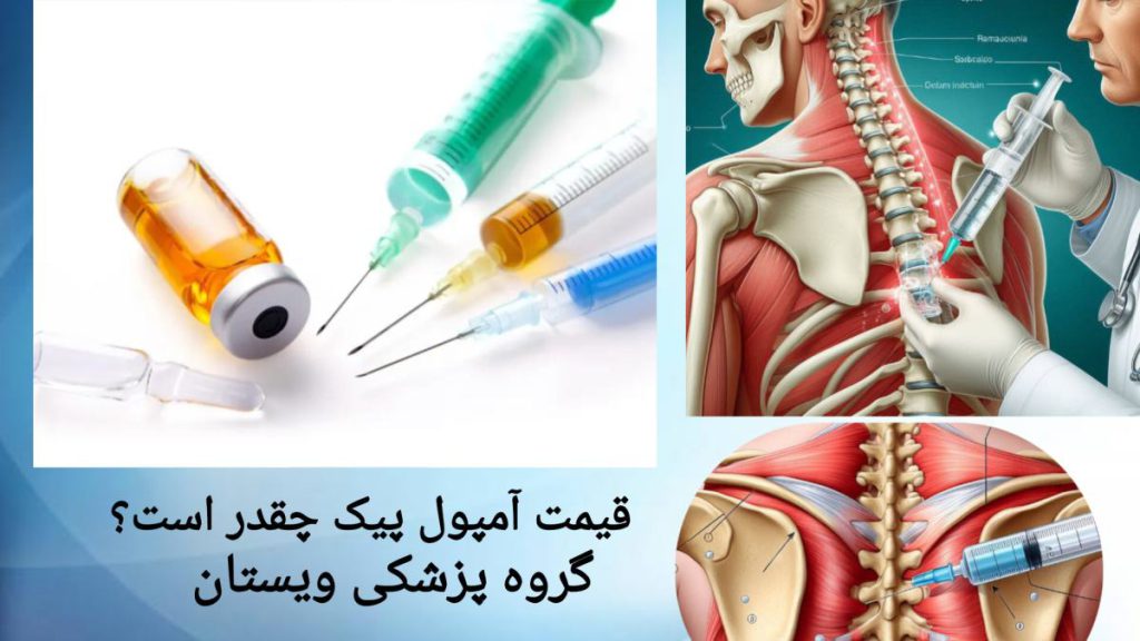 انجام اوزون تراپی دیسک کمر برای بیمار نمایی از آمپول پیک و انجام اوزون تراپی توسط پزشک