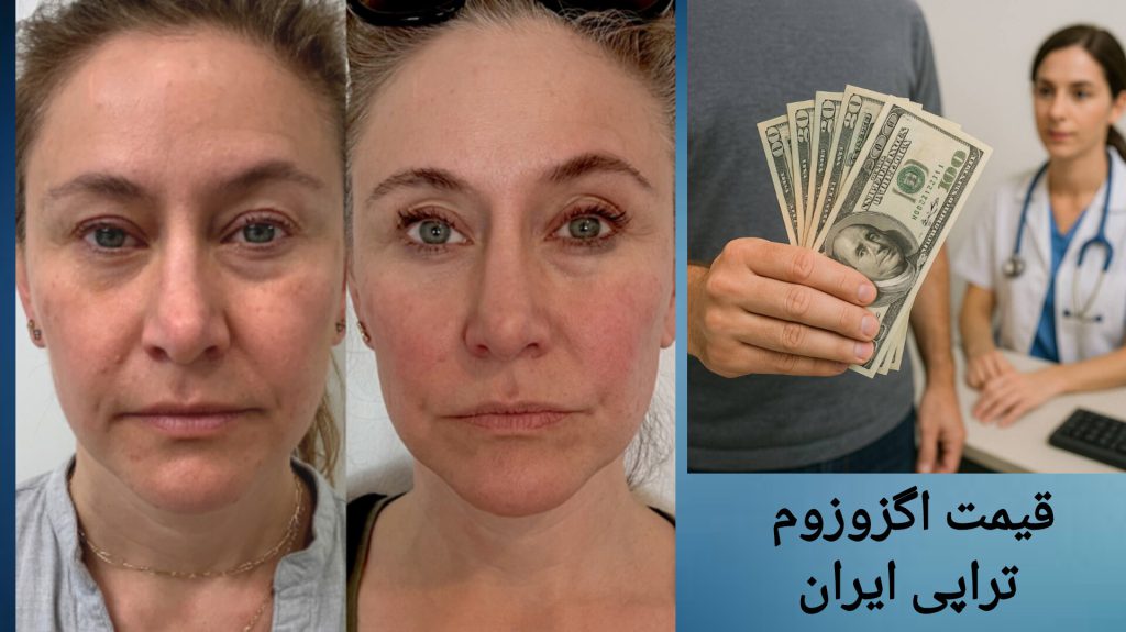 تصویری از قبل و بعد از اگزوزوم تراپی صورت و هزینه اگزوزوم تراپی مقایسه قبل و بعد از اگزوزوم تراپی و هزینه آن در ایران