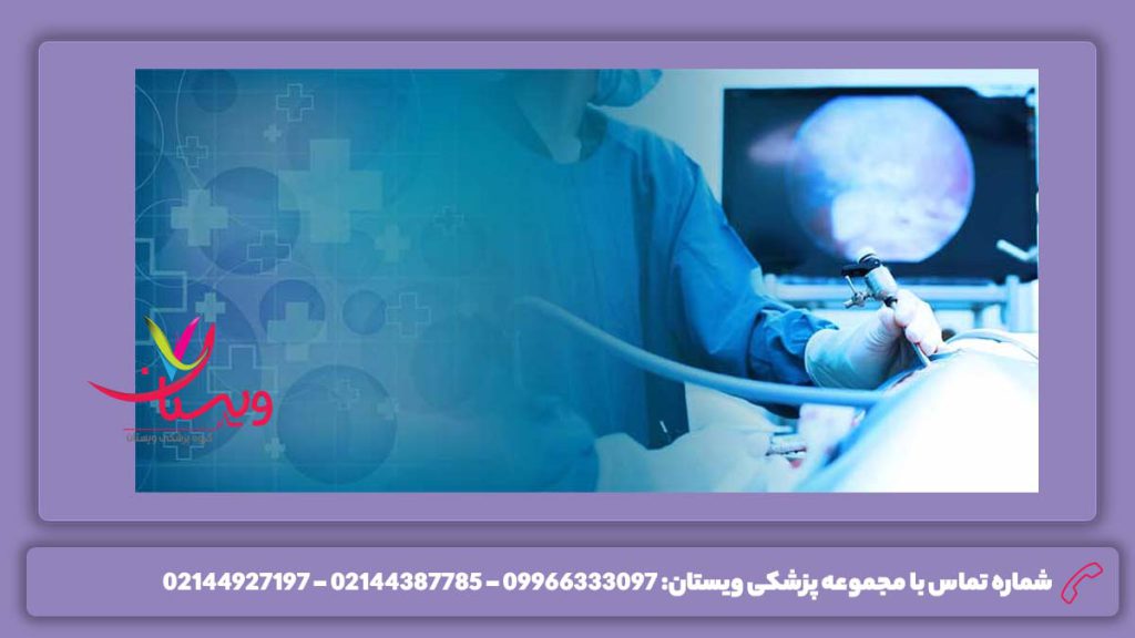 نرخ دولتی فیبروم رحمی قیمت جراحی لاپاراسکوپی در بیمارستانها