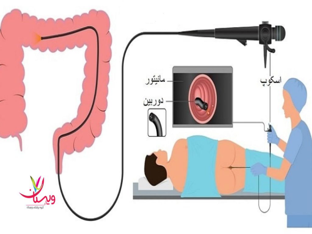 بیوپسی قیمت کولونوسکوپی با بیمه
