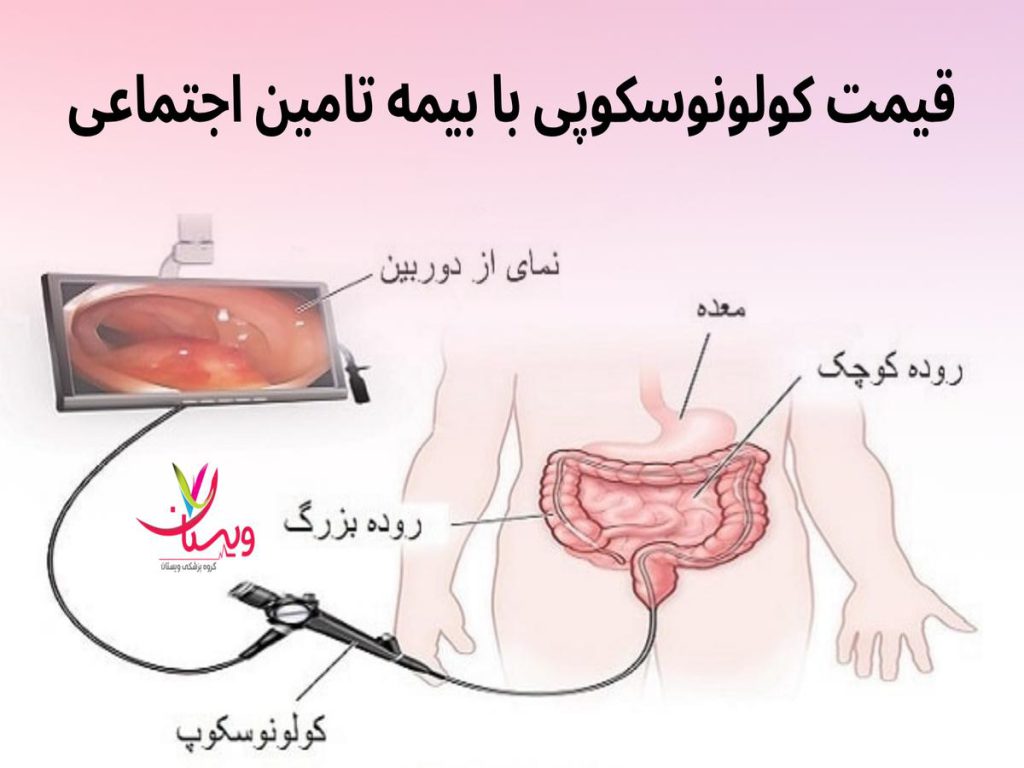بیمه تامین اجتماعی قیمت کولونوسکوپی با بیمه تامین اجتماعی