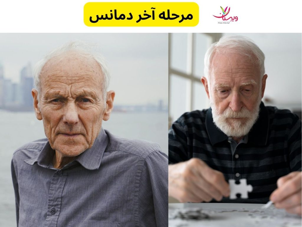 مرحله آخر دمانس