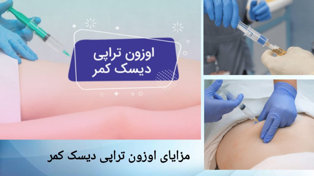انجام اوزون تراپی دیسک کمر توسط پزشک متخصص پزشک برای درمان دیسک کمر بیمار، اوزون تراپی انجام می دهد.
