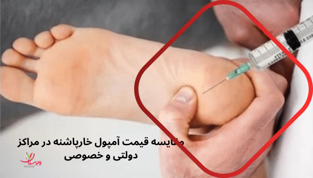 مقایسه تعرفه در مراکز دولتی و خصوصی هزینه تزریق آمپول خارپاشنه در مراکز دولتی