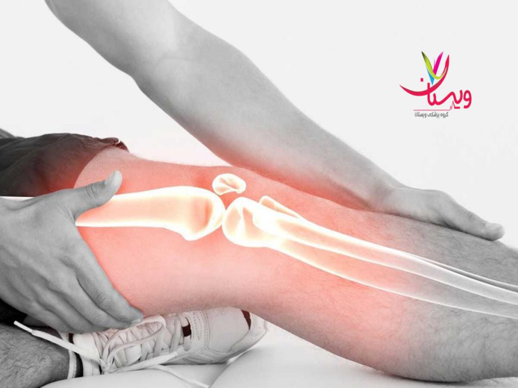 آرتریت روماتوئید میوپاتی چیست