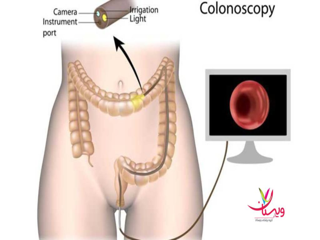 نمونهبرداری یا بیهوشی هزینه آندوسکوپی در بیمارستان دولتی (2)