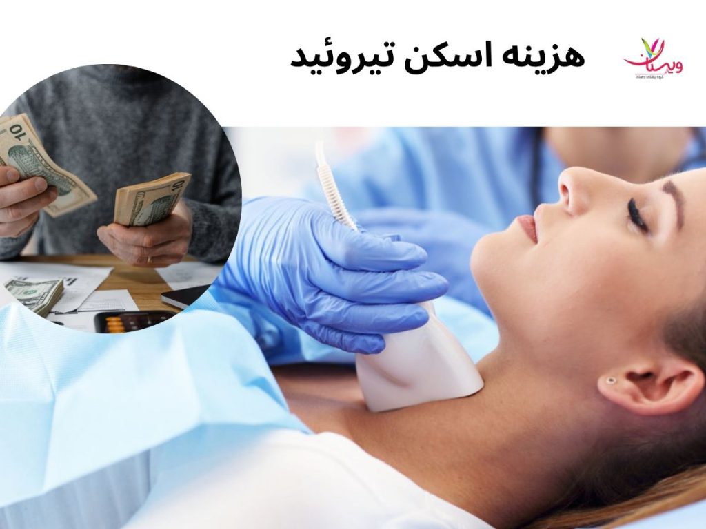 قیمت اسکن تیروئید هزینه اسکن تیروئید
