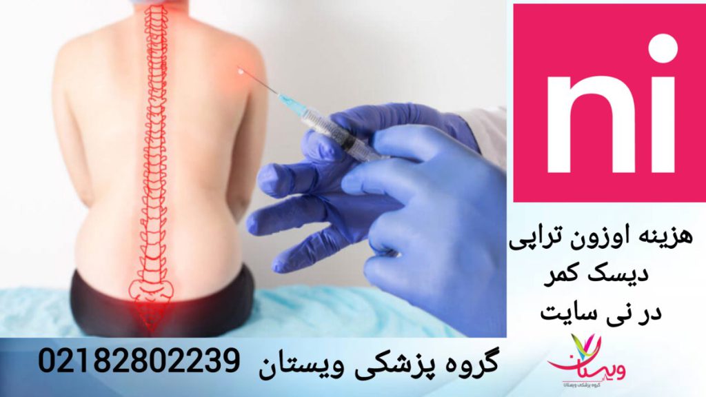 نظرات کاربران نی نی سایت در مورد هزینه اوزون تراپی دیسک کمر انجام اوزون تراپی دیسک کمر و نظرات کاربران نی نی سایت