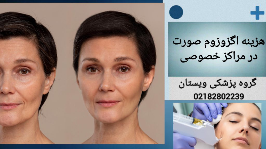 انجام اگزوزوز تراپی در مراکز خصوصی هزینه اگزوزوم صورت در مراکز خصوصی و کلینیک ویستان