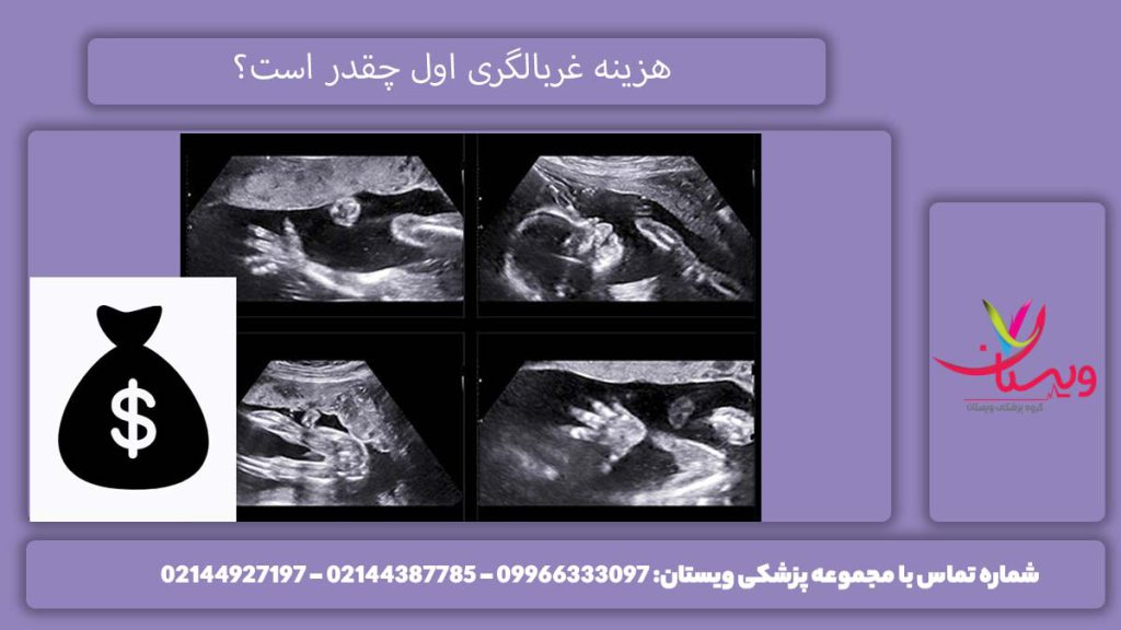 هزینه غربالگری اول چقدر است؟