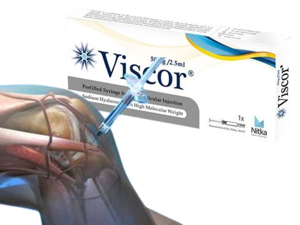 درمان ساییدگی زانو با ژل تزریق ژل ویسکور به زانو