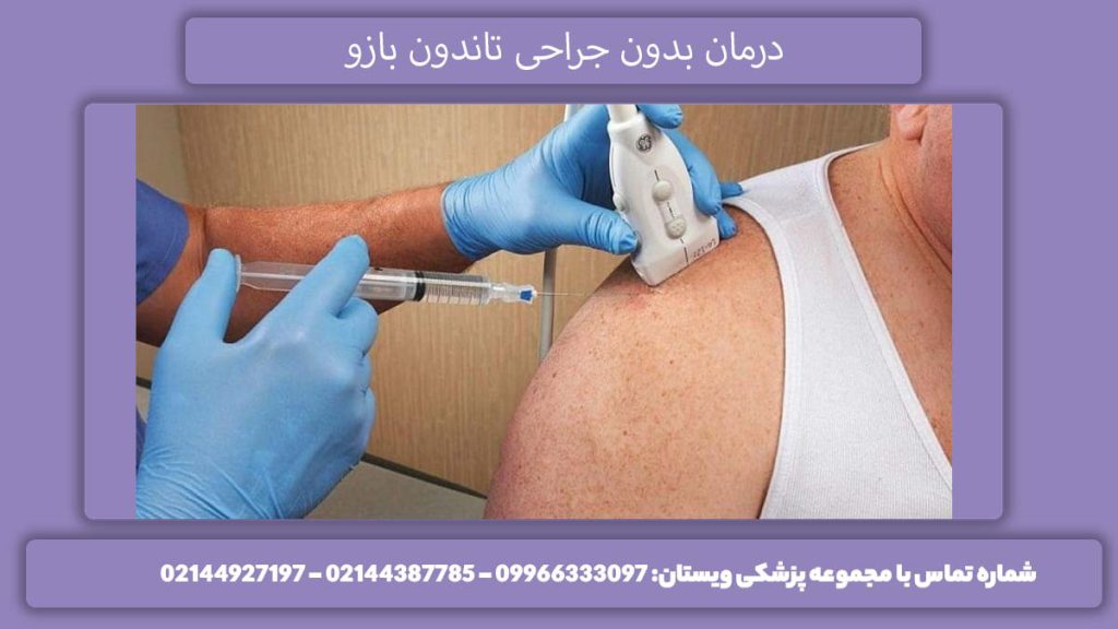 روش درمانی بدون انجام جراحی درمان بدون جراحی تاندون بازو