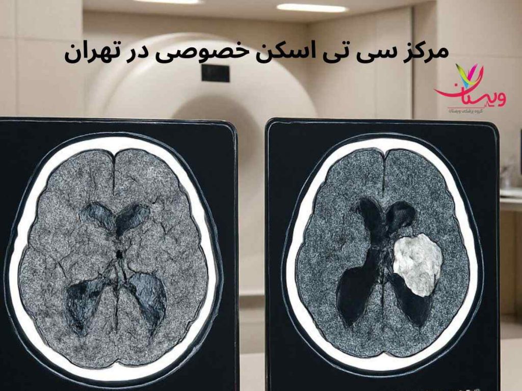 سی تی اسکن مغز مرکز سی تی اسکن خصوصی در تهران