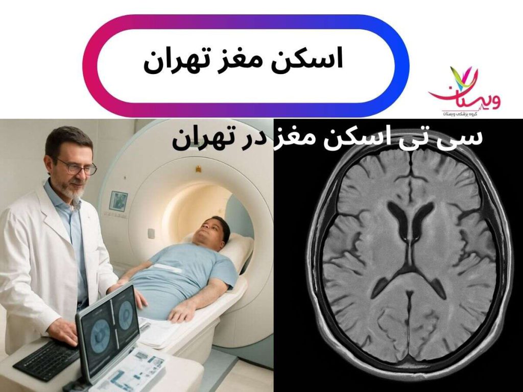 اسکن مغز در تهران اسکن مغز تهران