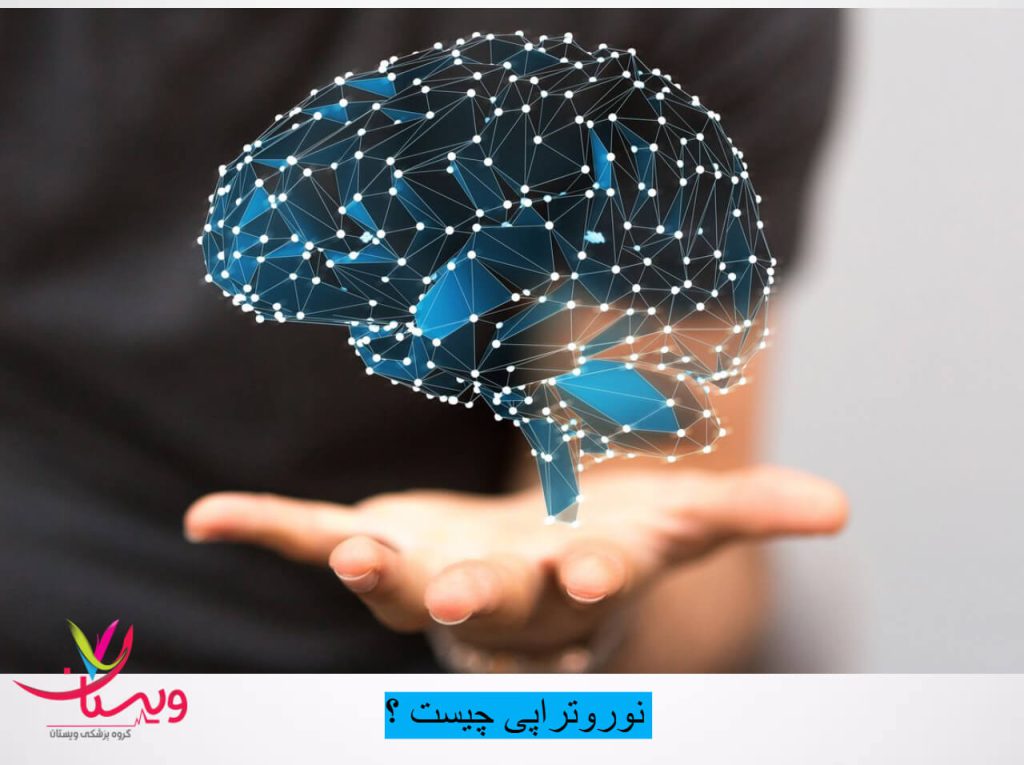 تصویر عصبهای مغز تصویر عصبهای مغز