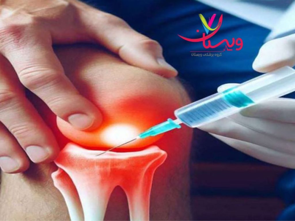 مفصل ساز زانو نکات مراقبتی بعد از تزریق ژل مفصل ویسکور