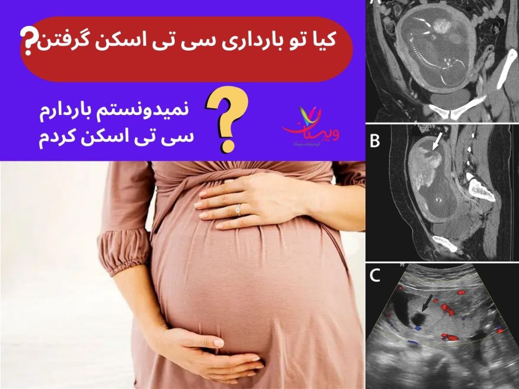 چند بار سی تی اسکن مضره کیا تو بارداری سی تی اسکن گرفتن