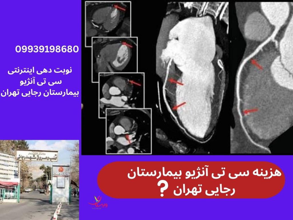 بیمارستان شهید رجایی قلب تهران هزینه سی تی آنژیو بیمارستان رجایی تهران