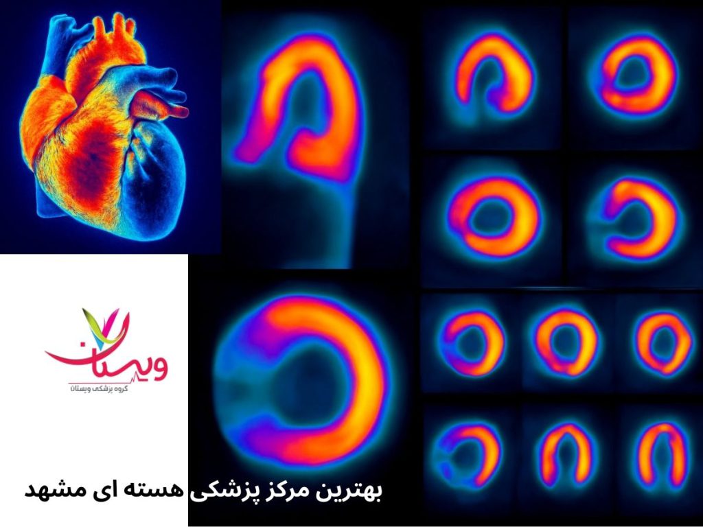 مرکز پزشکی هستهای سینا بهترین مرکز پزشکی هسته ای مشهد