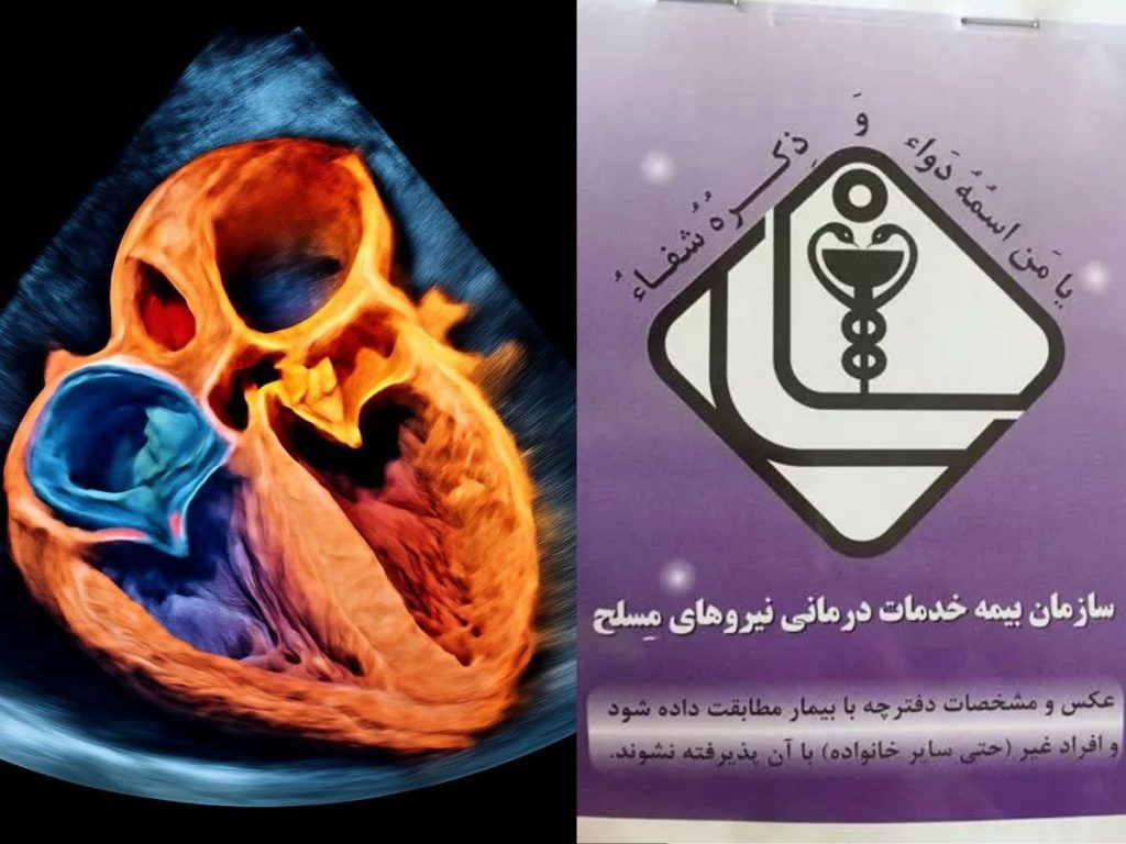 بیمه برای اکو قلب بیمه های طرف قرارداد بیمارستان قلب تهران