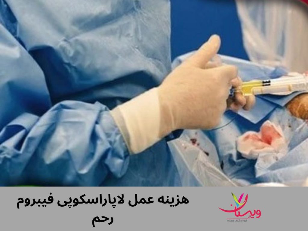 هزینه عمل لاپاراسکوپی فیبروم رحم