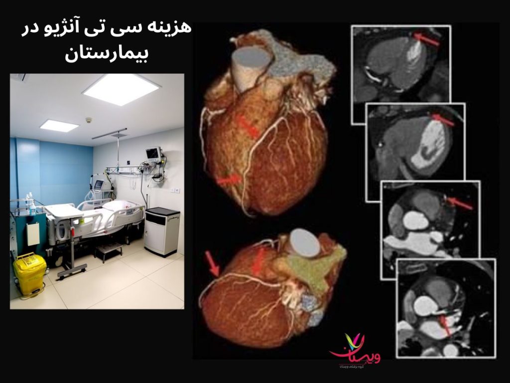 تعرفه سی تی آنژیوگرافی در تهران با بیمه ها