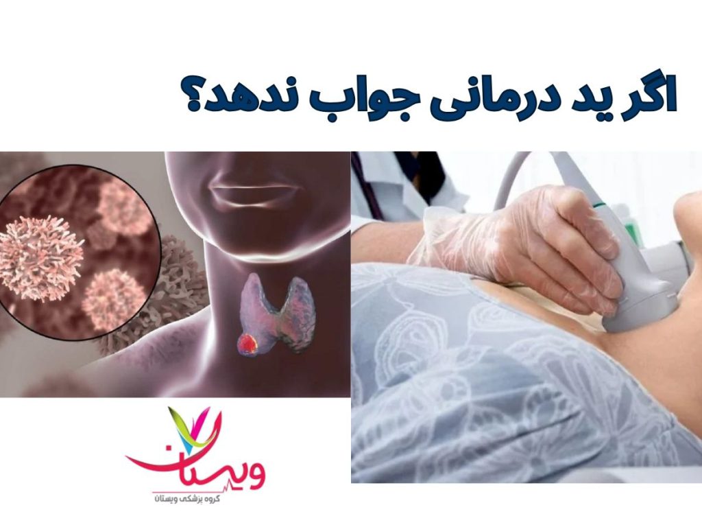 پاسخ ندادن ید درمانی اگر ید درمانی جواب ندهد