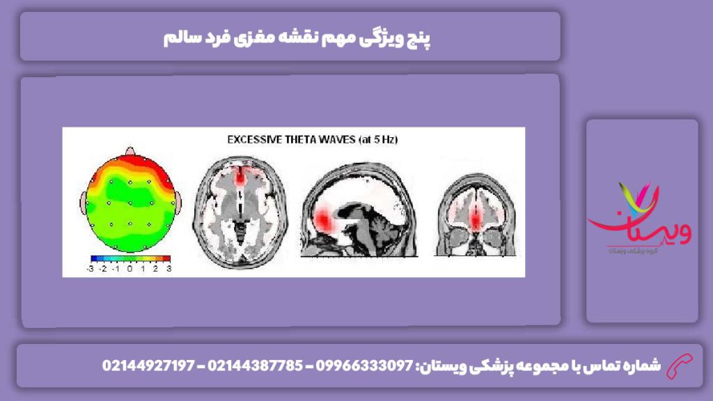 مزایای نقشه مغز فرد سالم نقشه مغزی فرد سالم