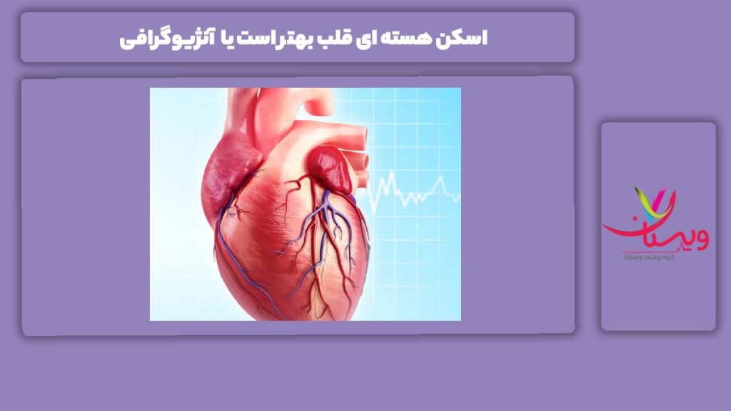فرق بین اسکن هسته ای و آنژیو اسکن هسته ای قلب بهتر است یا آنژیوگرافی