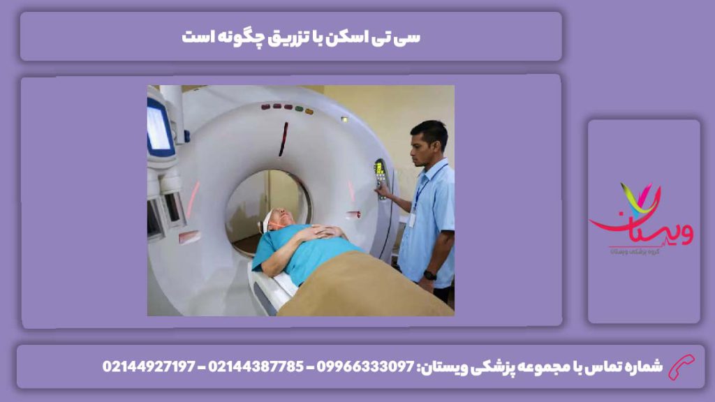 نحوه انجام سی تی اسکن با تزریق سی تی اسکن با تزریق چگونه است
