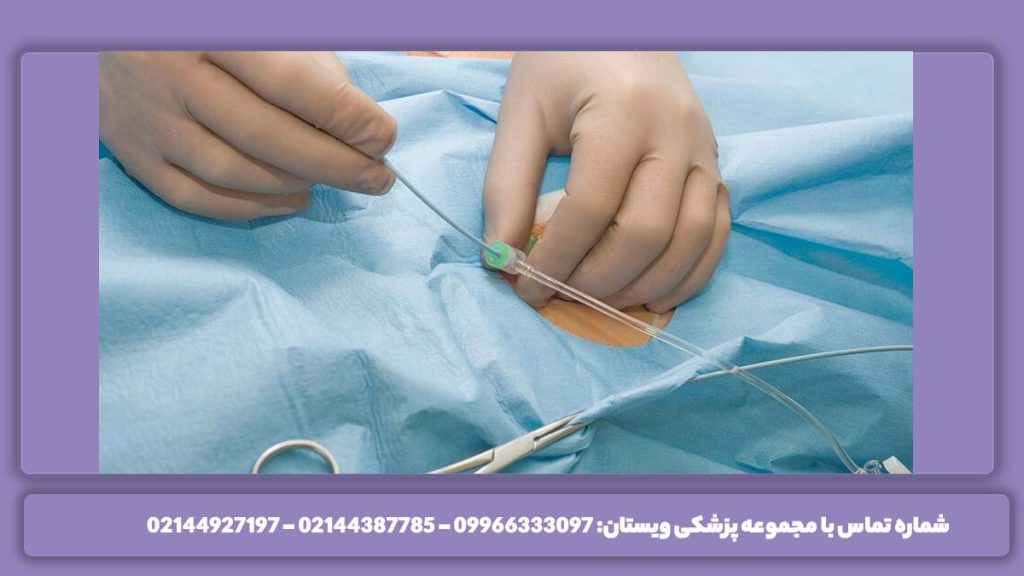 فواید انجام آنژیوگرافی فواید سی تی آنژیو سر و گردن