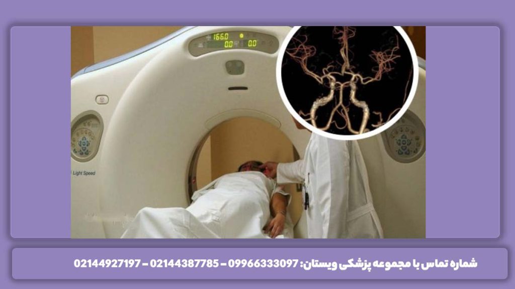 چگونگی تصویربرداری رگهای مغز نحوه انجام سی تی آنژیو مغز