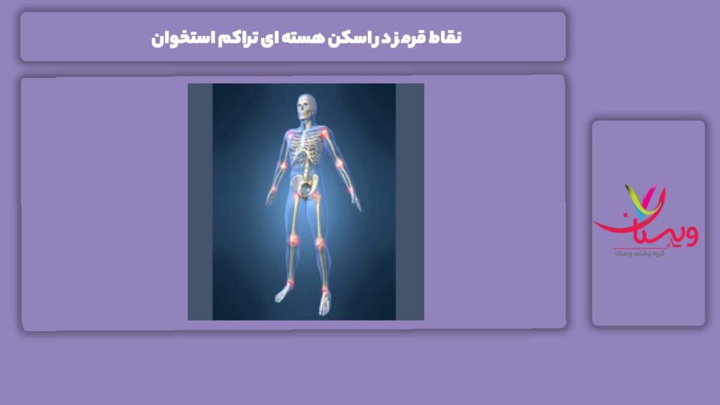 دلایل نقطههای قرمز در اسکن تراکم استخوان نقاط قرمز در اسکن هسته ای تراکم استخوان