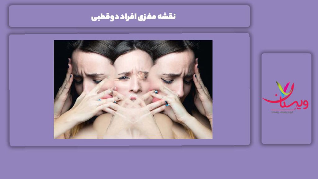 نقشه مغز فرد دو قطبی نقشه مغزی افراد دوقطبی