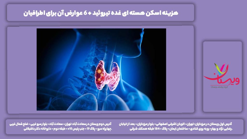اسکن هسته ای غده تیروئید