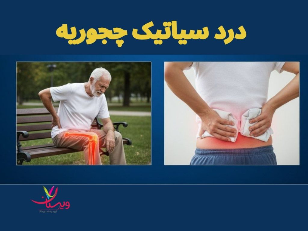 درد سیاتیک در انجمن نی نی سایت درد سیاتیک چجوریه نی نی سایت