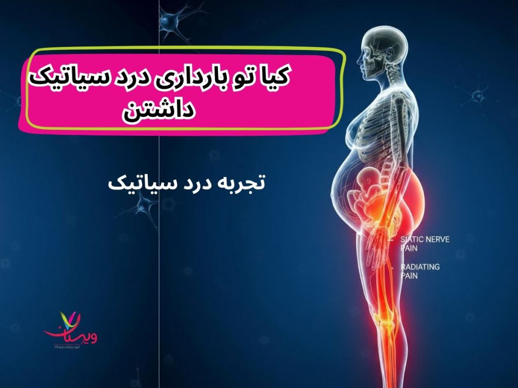 درد سیاتیک در بارداری درد سیاتیک پای راست در بارداری نی نی سایت