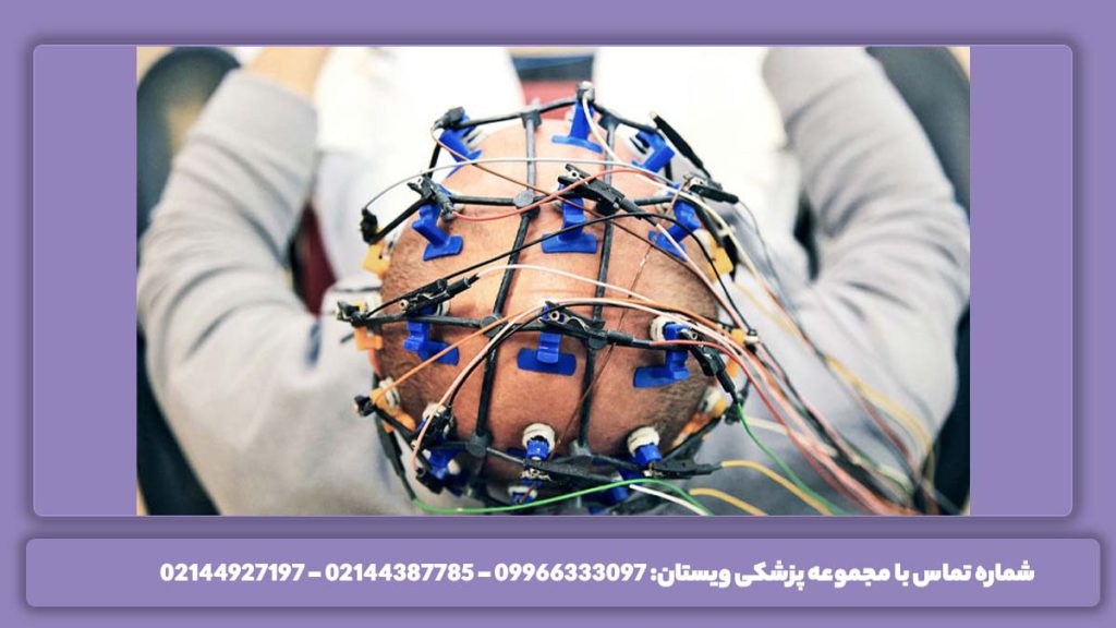 عکس نوار مغز میگرن چگونگی تشخیص میگرن با نوار مغز