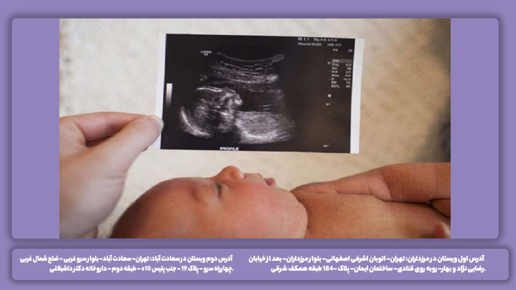 مدت اسکن قلب اکوی قلب چقدر طول میکشد؟