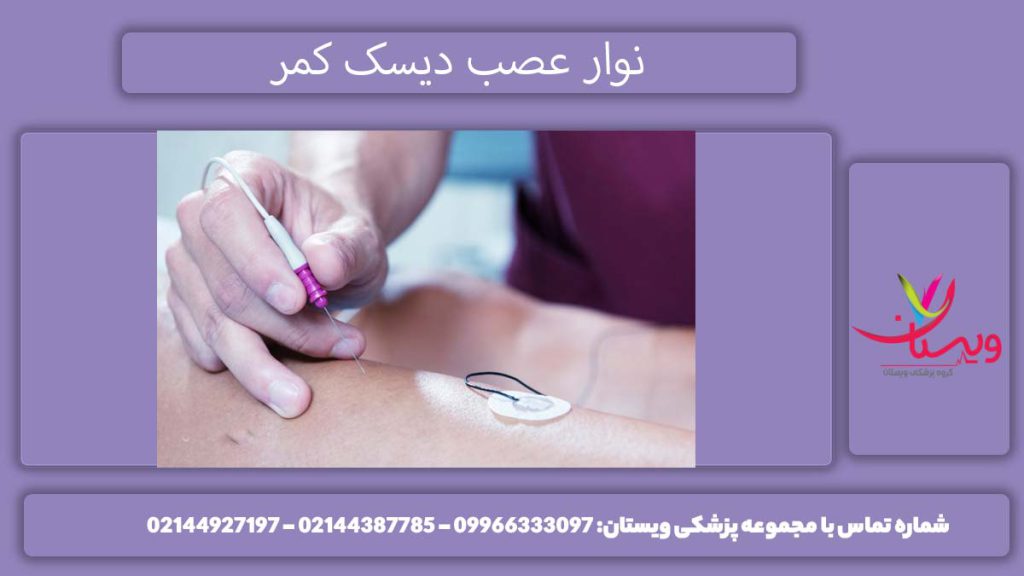 نوار عصب و عضله دیسک کمر چیست؟