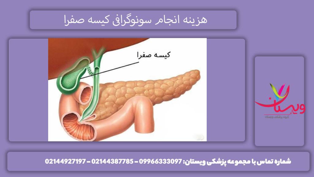 هزینه سونوگرافی کیسه صفرا
