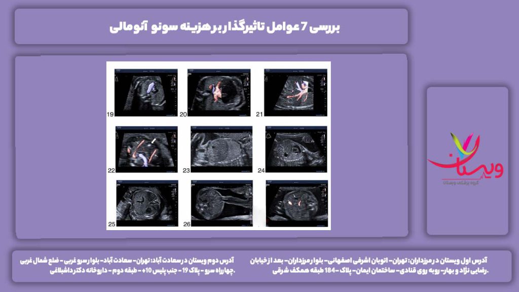 هزینه سونو آنومالی