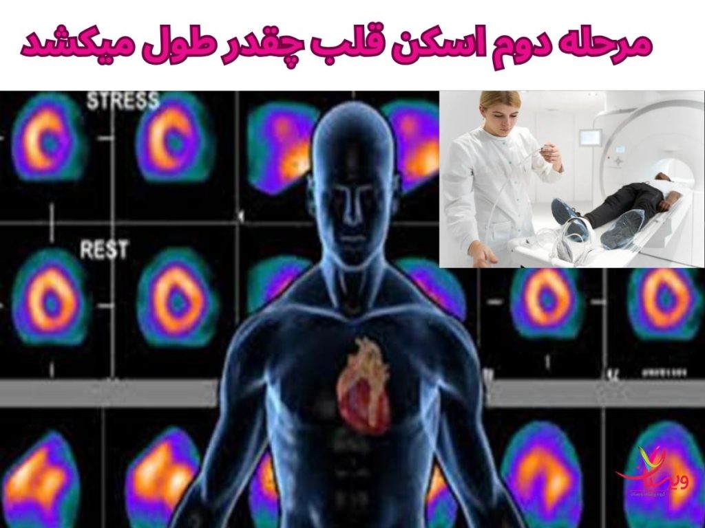 داروی اسکن دوم قلب مرحله دوم اسکن قلب چقدر طول میکشد