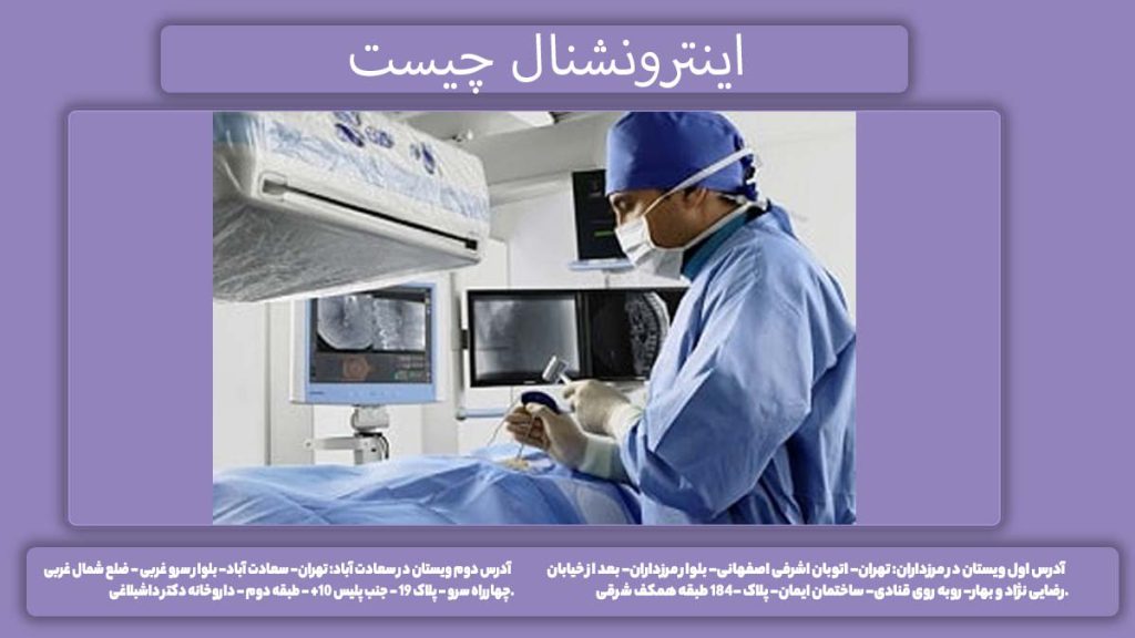 بررسی اینترونشنال اینترونشنال چیست