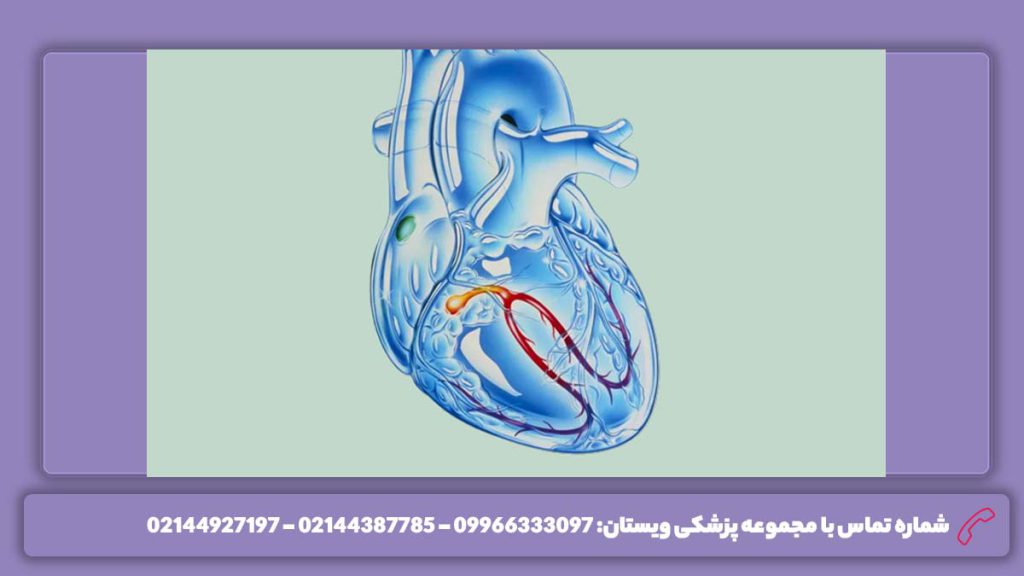 دکتر فلوشیپ الکتروفیزیولوژی متخصص فلوشیپ اینترونشنال کاردیولوژی چیست