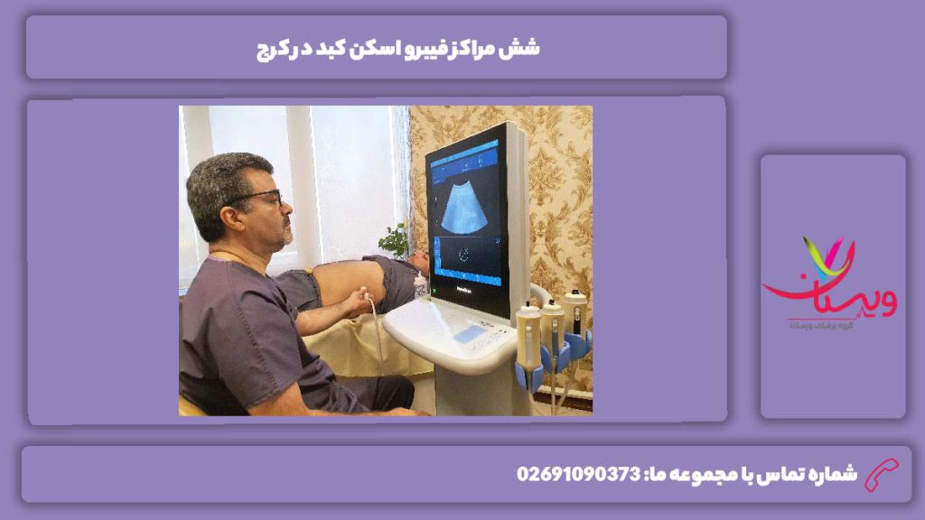 مراکز مهم نوبت فیبرو اسکن کبد در کرج