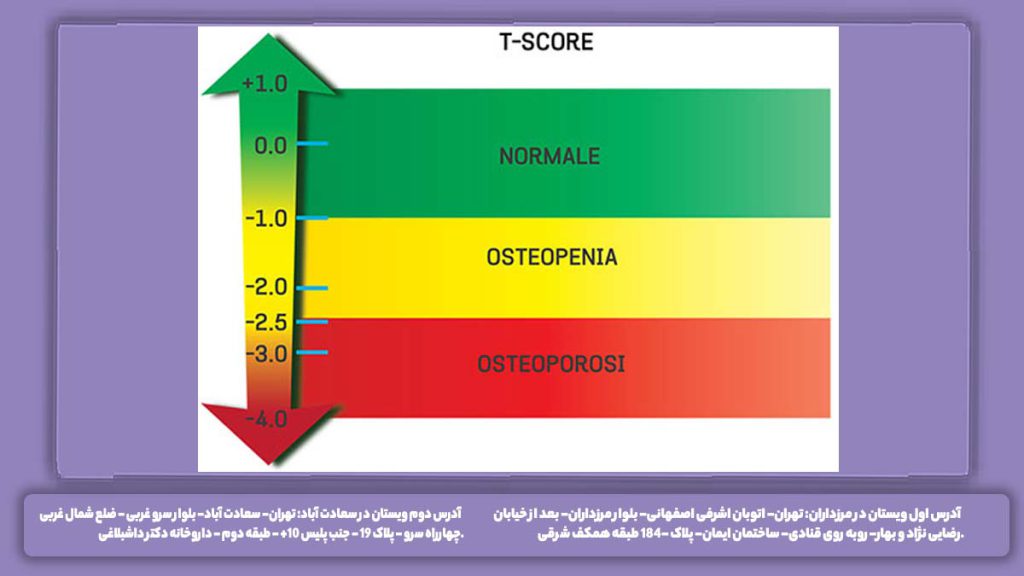 Z score در تراکم استخوان چیست Z score در تراکم استخوان چیست