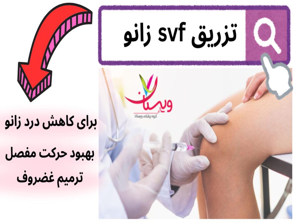 سلولهای ترمیمکننده تزریق svf زانو